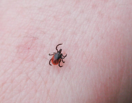 Tick-Borne Illnesses